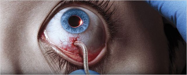 Attention phobie : Quand les scénaristes torturent nos yeux à l'écran ! (1/2) Attention phobie : Quand les scénaristes torturent nos yeux à l'écran ! (1/2)