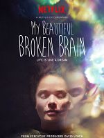 My Beautiful Broken Brain