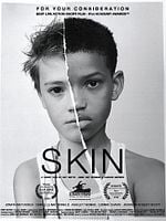 Skin (Short)