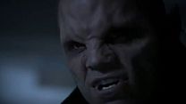 image de Teen Wolf - saison 3 - épisode 9 Teaser VO