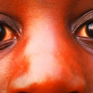 Photo Sous l’oeil de Pancrace