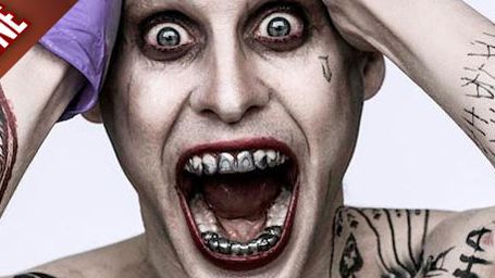 image de la news FanZone : 400... et toutes ses dents ! 