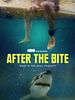 poster de After the Bite
