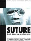 Suture : Affiche