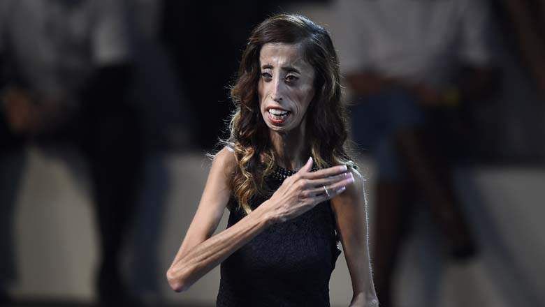 A Brave Heart: The Lizzie Velasquez Story : Photo
